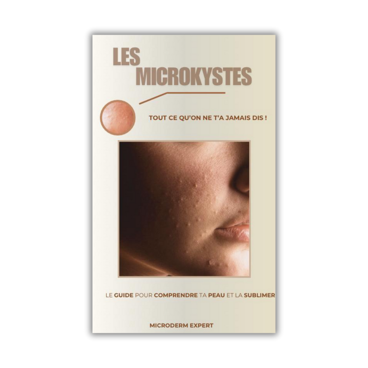 E-book - Mycrokystes : La Vérité Qui Dérange
